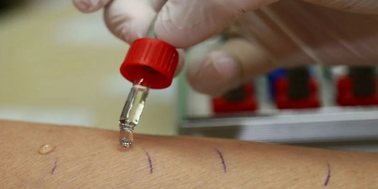 Alerjik Çocuklar İçin Ailelere 14 tavsiye