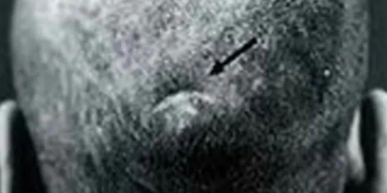 Tıp dünyası şokta! Mucizevi bir şekilde hayatta kalan adam ters görmeye başladı