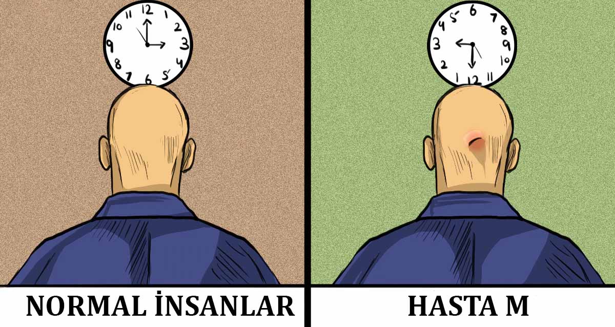 Tarihteki En Tuhaf Beyin Hasarı Vakası: Başından Vurulduktan Sonra Dünyayı Ters Görmeye Başlayan Adam