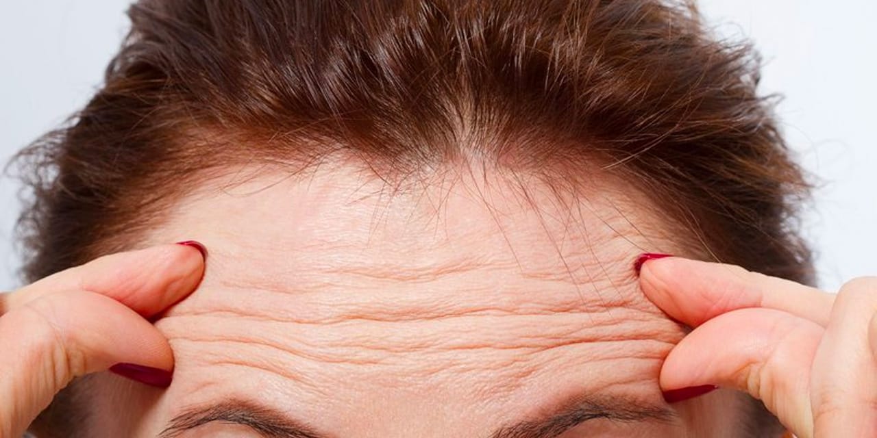 Alın kırışıklıklarını botoks yaptırmadan geçirmenin çözümünü paylaştı! Bu yöntem ile hep genç görüneceksiniz!