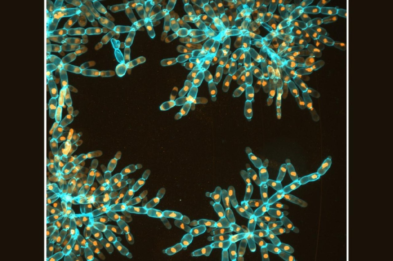 Ünlü dizi The Last Of Us Gerçek Oldu! Mantar Mutasyona Uğradı, Tam 20 bin Kat Büyüdü