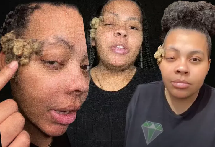 Doğum Lekesi zannediyordu Gerçek Bambaşka çıktı! Doktor Bile Çare Aradı