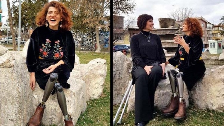 İçişleri Bakanlığı'ndan IŞİD saldırısında bacaklarını kaybeden dansçı kadına tazminat