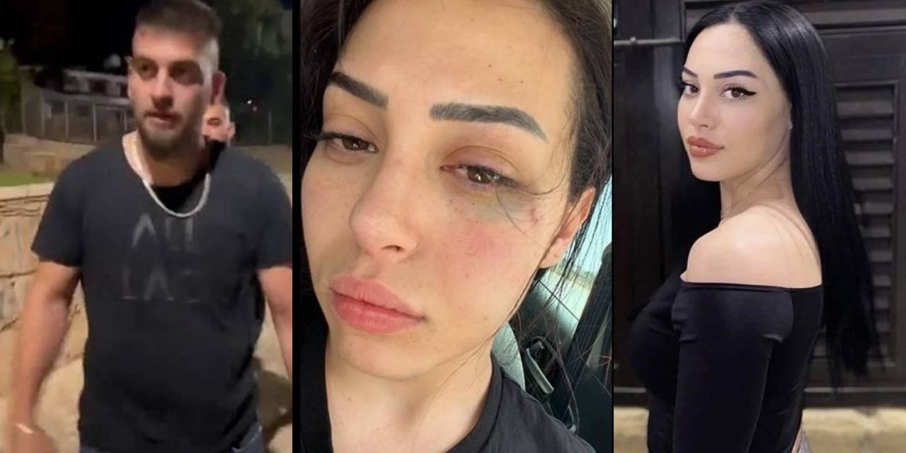 Güney Kıbrıs'ta Türk kızına dehşeti yaşattılar: Dövdüler, duvardan attılar! 2 Rum saldırgan gözaltında