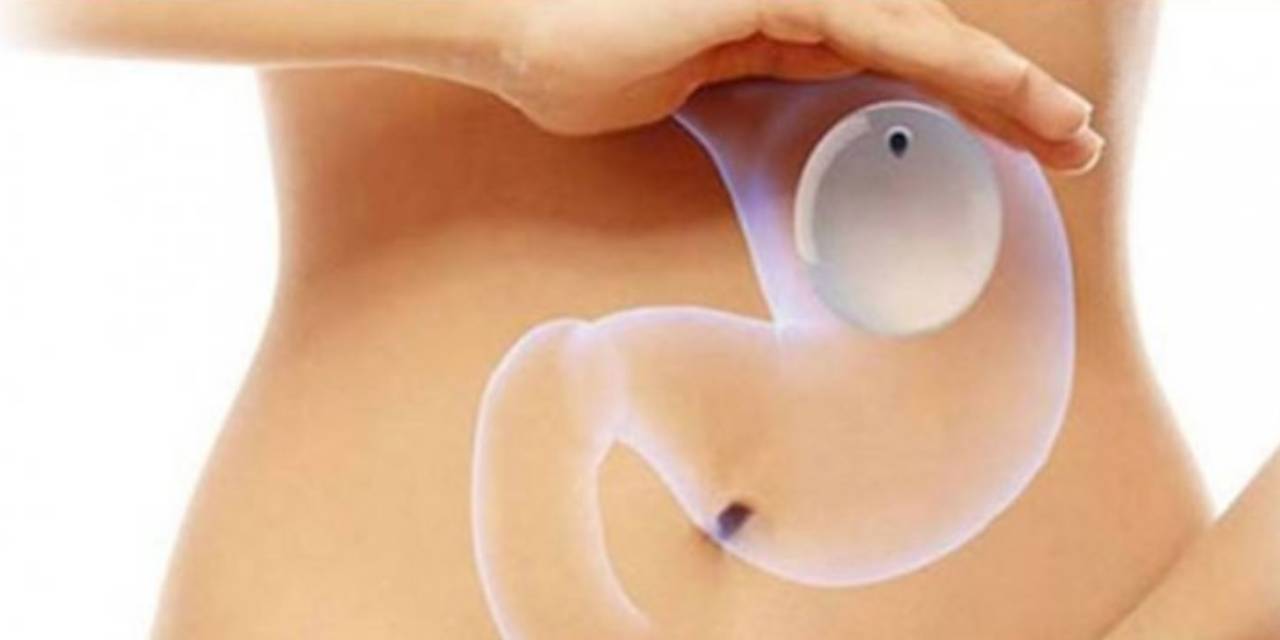 Mide Balonunun Ölüm Riski Var Mı?