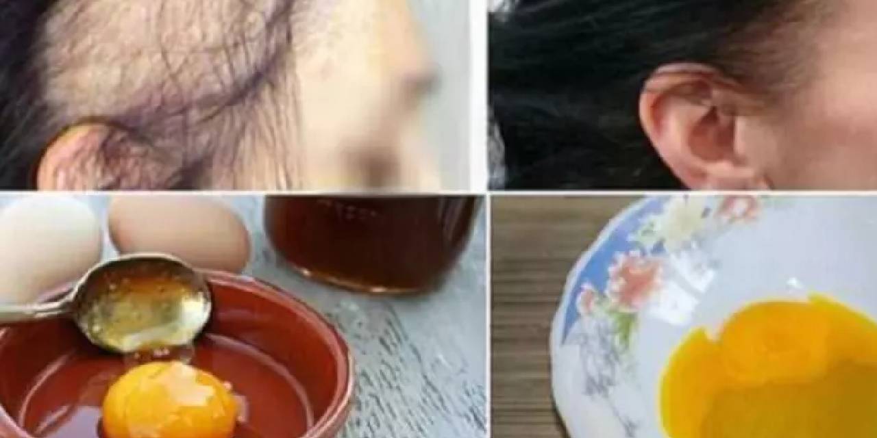 Saç ekimi etkisi yaratıyor! 3 malzemeyle adeta saç fışkırtıyor: Saçınız uzamıyor mu? Bunları kesinlikle yapmanız gerekiyor ...