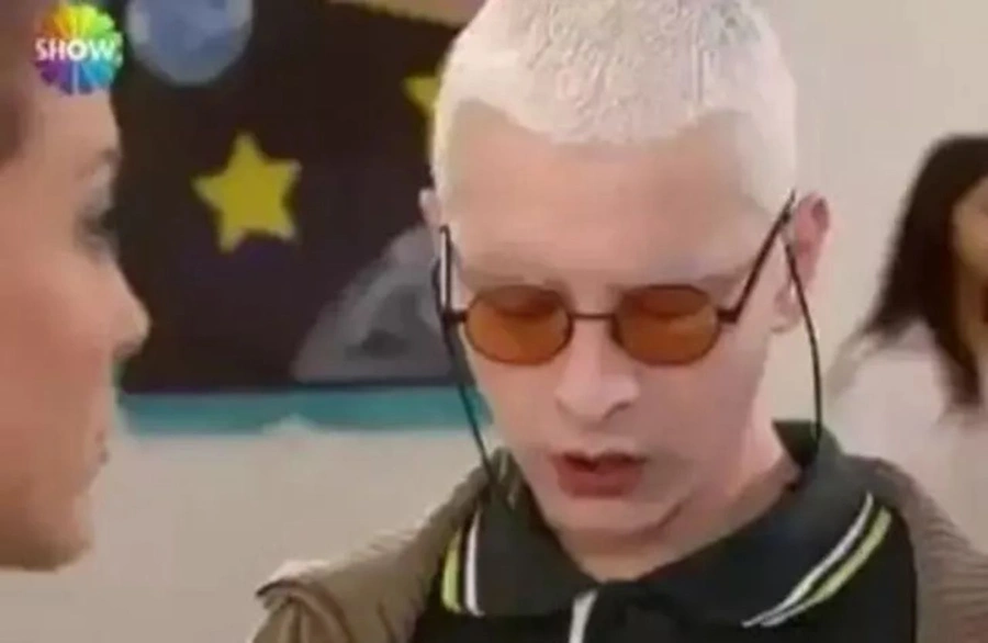 Herkes onu albino hastası sanıyordu gerçek bambaşkaymış! Gerçek halini görünce çok şaşıracaksınız