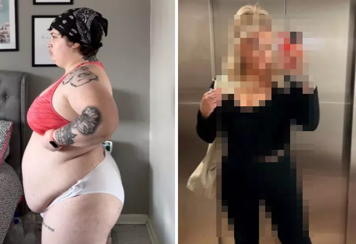 Türkiye'ye gelip mide ameliyatı ile zayfıladı! Verdiği kilolar yüzünden en yakınları bile tanımakta zorluk çekiyor