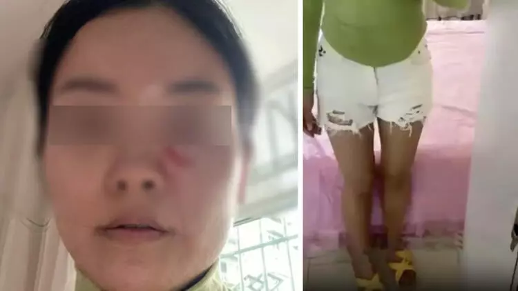 Gelininin şortunu kısa bulan kayınpeder öfkeden deliye döndü! Sıcak çorbayı başından aşağı döküp genç kadını haşladı