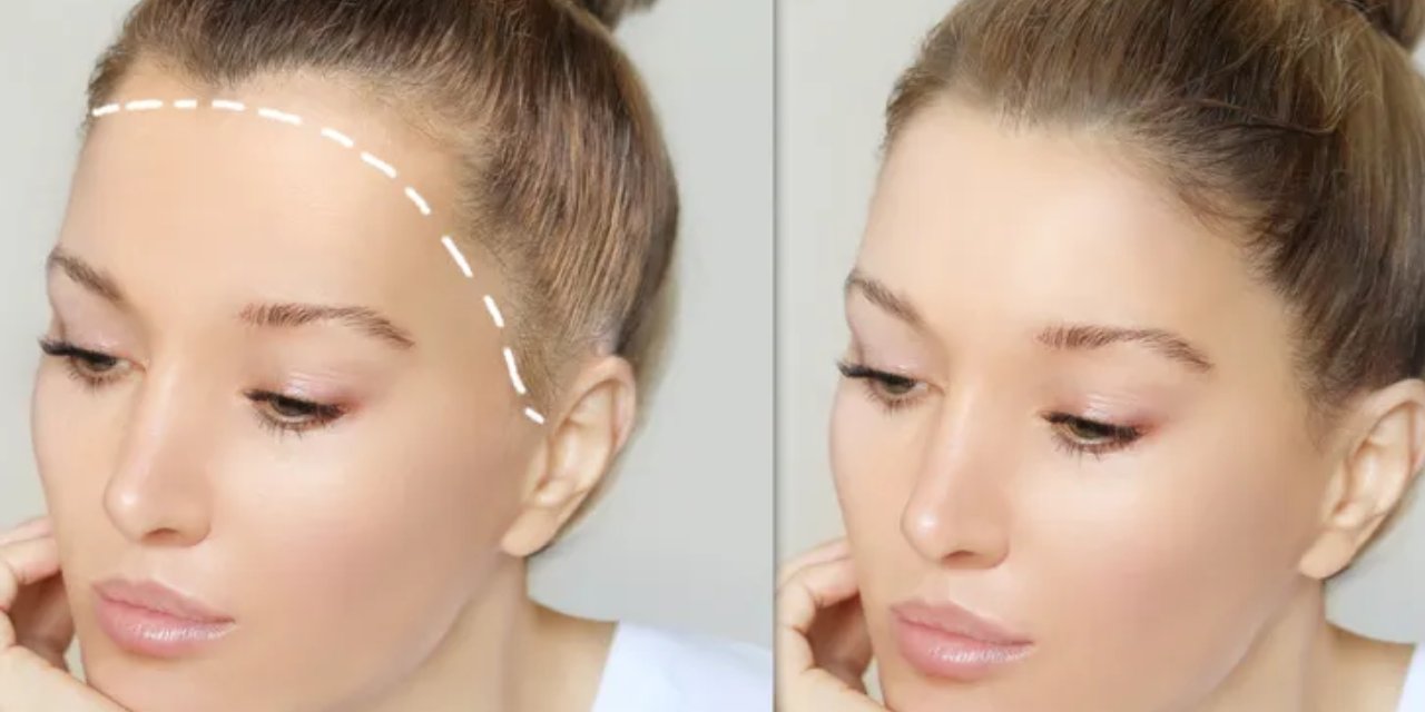 Saç dökülmesini durduran en etkili yöntem! Yeni saçların çıkması için şampuanınıza ekleyin