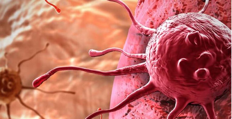 Tıpta Yeni Atılım: Agresif Kanser Hücreleri Böyle Yok Edildi