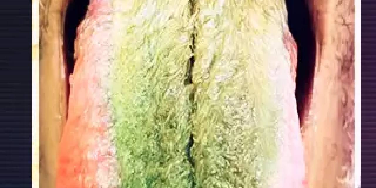 Görenler şaşırdı...Doktorları bile şaşkına çevirdi! Dili bir anda yeşil renge döndü ve tüylenmeye başladı...