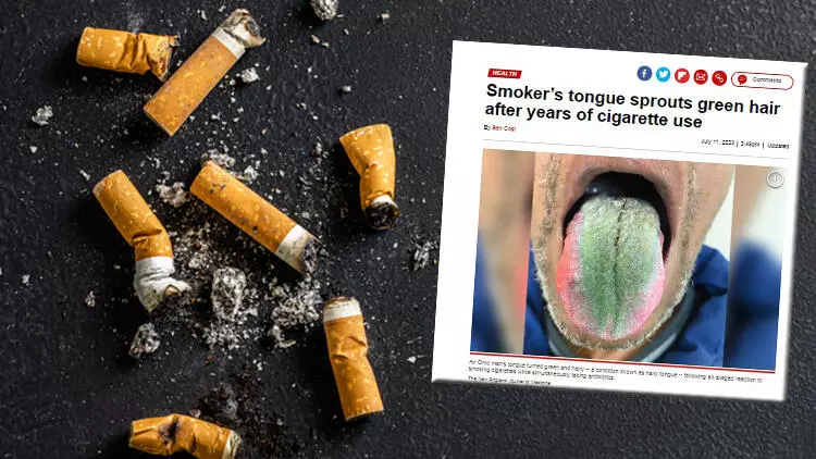 Sigara ile antibiyotik birleşince...Dilinde tüy bitti