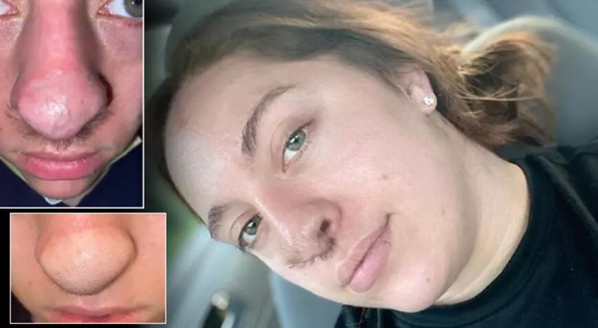 Böyle ameliyat görülmedi, şoke eden 'köpek' detayı! Burnundan saç çıkıyor