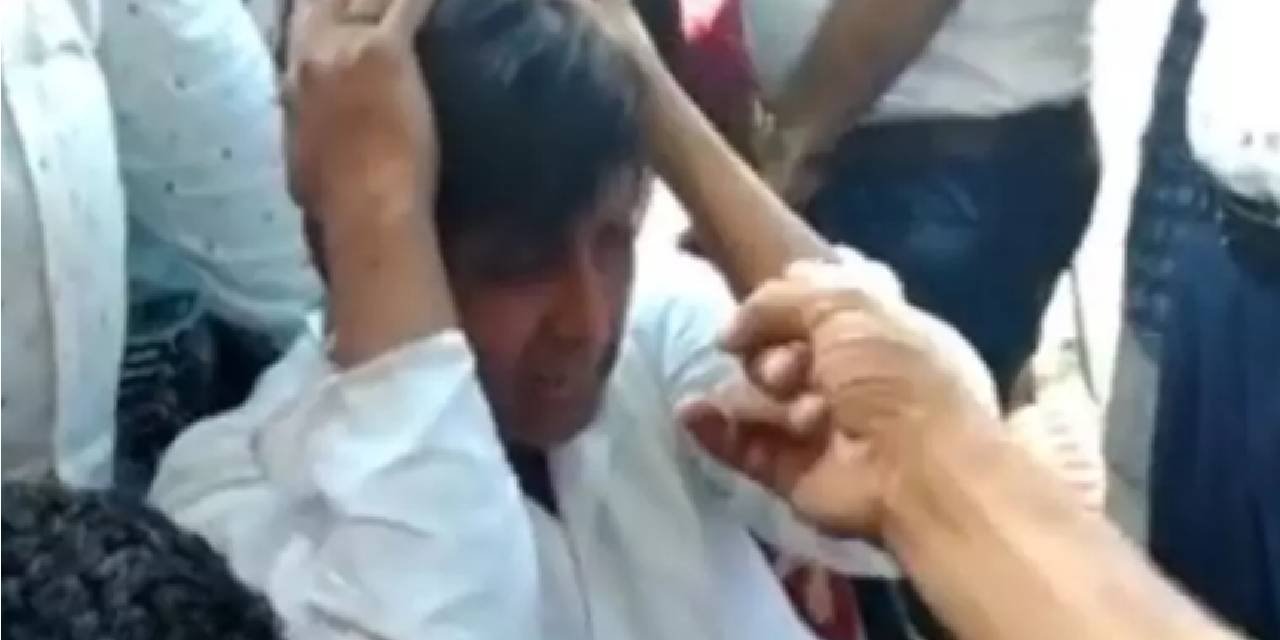 Kel Olduğu Anlaşılan Damat Meydan Dayağı Yedi