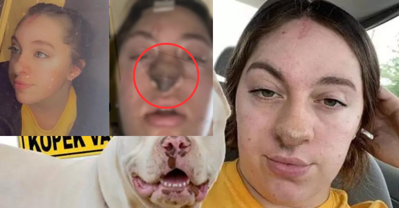 Dünya bu olayı konuşuyor! Ameliyat sonrası şok eden "köpek" detayı! Burnundan saç çıkıyor