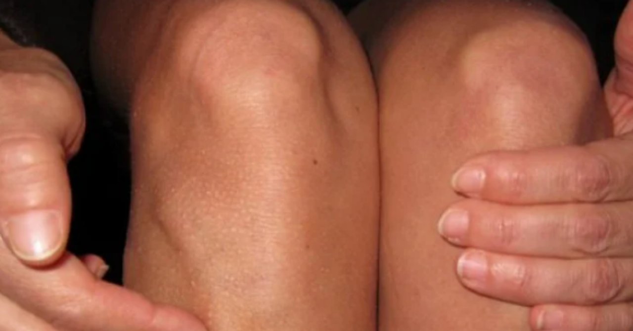 Çinliler Vücudu sıfırlama tuşunu buldu! Yapanlar 100 yaşına kadar yaşayabiliyor!