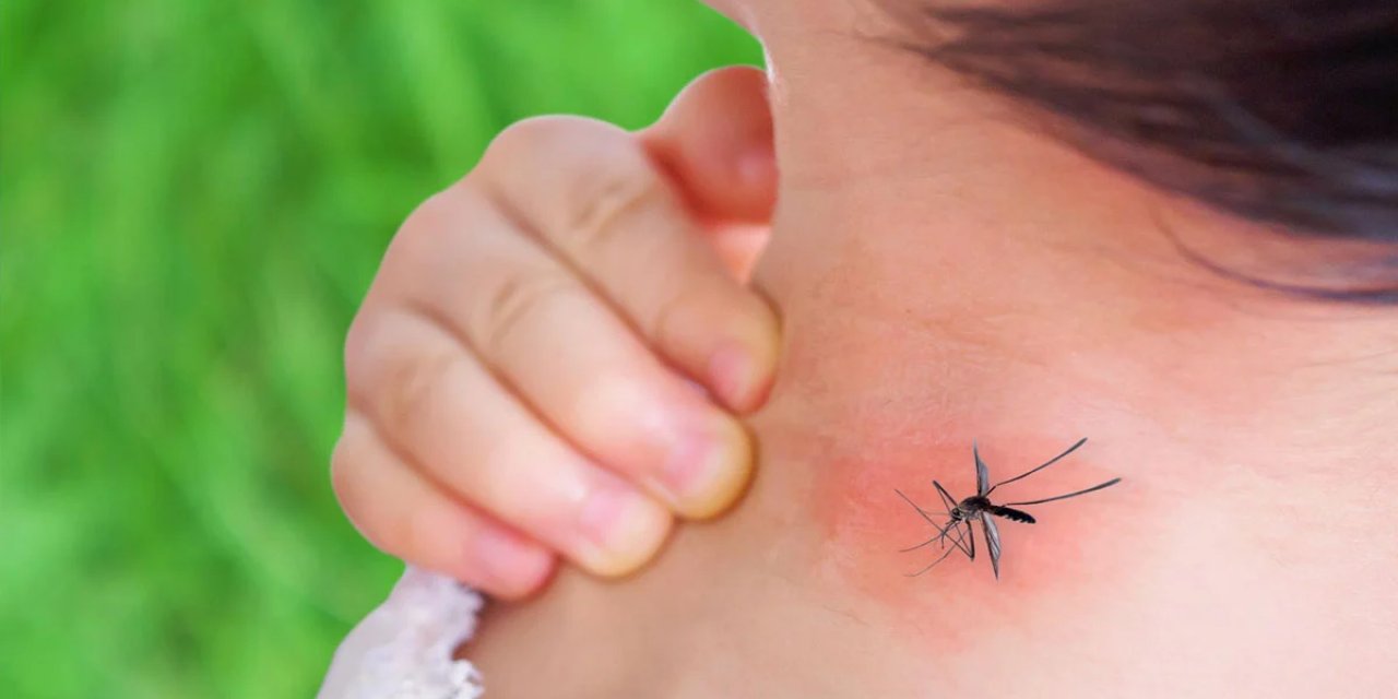 Sinek ısırığını şipşak geçiriyor! Sürün 5 dakika bekleyin