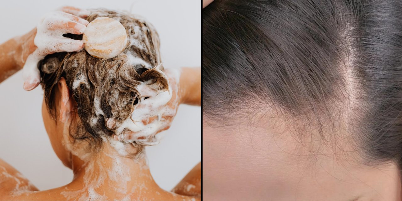 Bu Hatalar Kelliğe Bile Neden Oluyor! Saç Bakımında En Çok Yapılan O 5 Hata