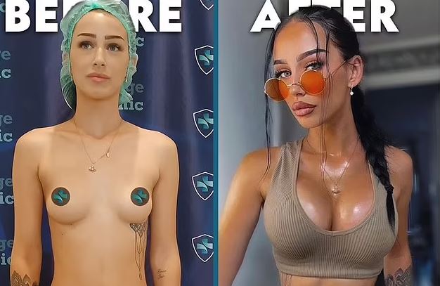 İstanbul'daki Estetik Merkezleri İngiliz Medyasının Hedefinde: OnlyFans Modelleriyle Pazarlıyorlar