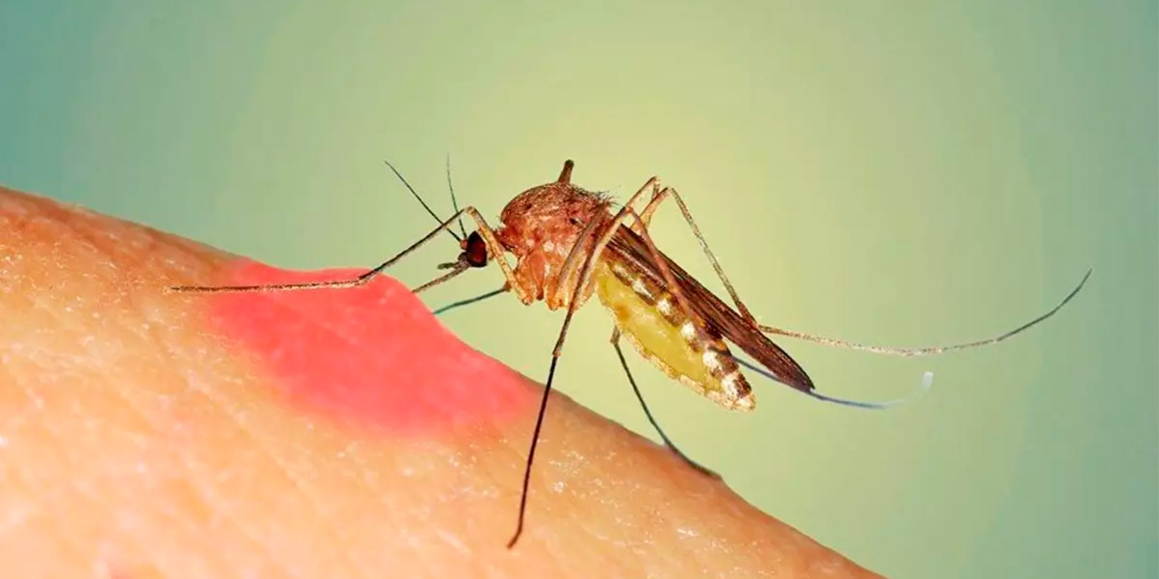 Sinek ısırığını 5 dakikada yok etmek mümkün! Ne kaşıntı kalacak ne de şişlik...