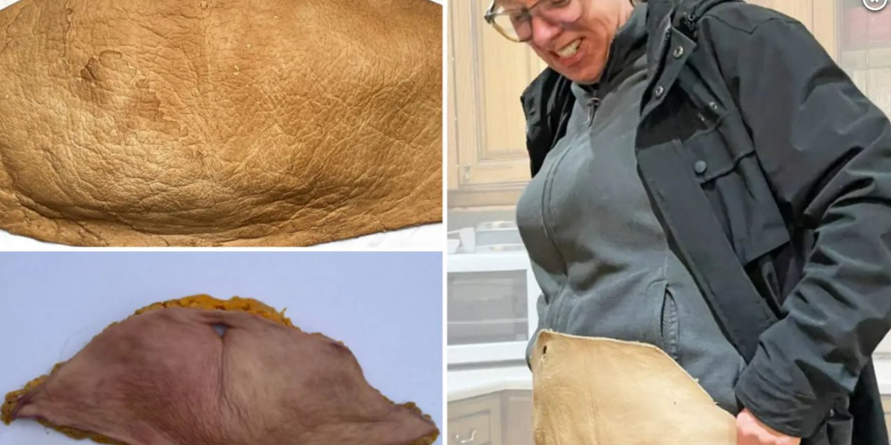 Sarkan Derisini Aldırdı... 'Sanat Eserine' Dönüştürdü