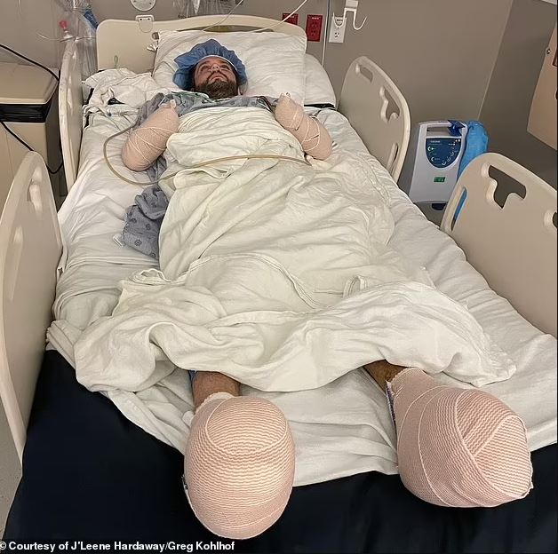 Pirenin Isırdığı 35 Yaşındaki Adam Neredeyse Ölüyordu! Önce Grip Sandılar, İki Eli ve Ayakları Kesildi...