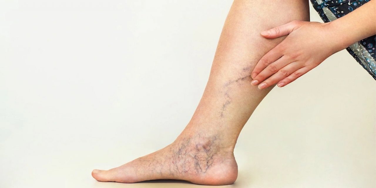 Kötü görüntüye son! Her evde bulunuyor, varisleri hızla geçiriyor