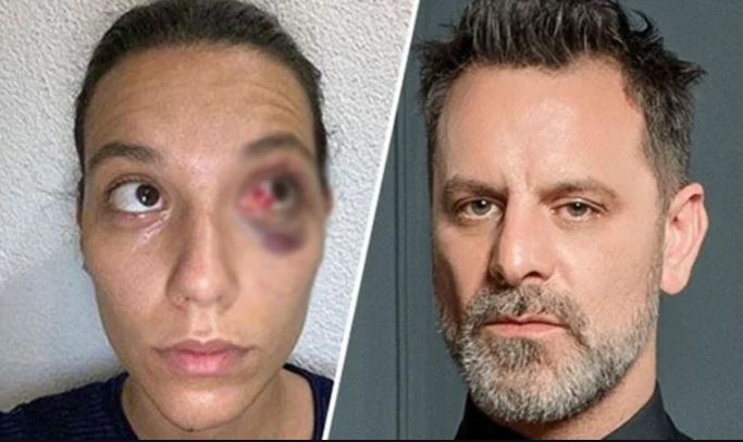 Ozan Güven ve Deniz Bulutsuz davasında flaş gelişme! Beklenen rapor çıktı