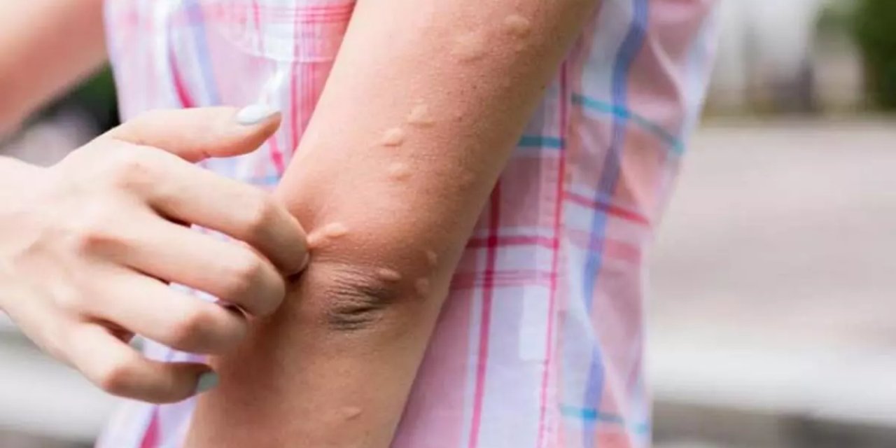 Türkiye için yeni belanın adı 'anofel'! Uzmanlar uyardı: Onu yok edin yoksa...