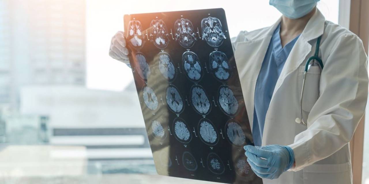 Alzheimer aşısının ilk sonuçları açıklandı