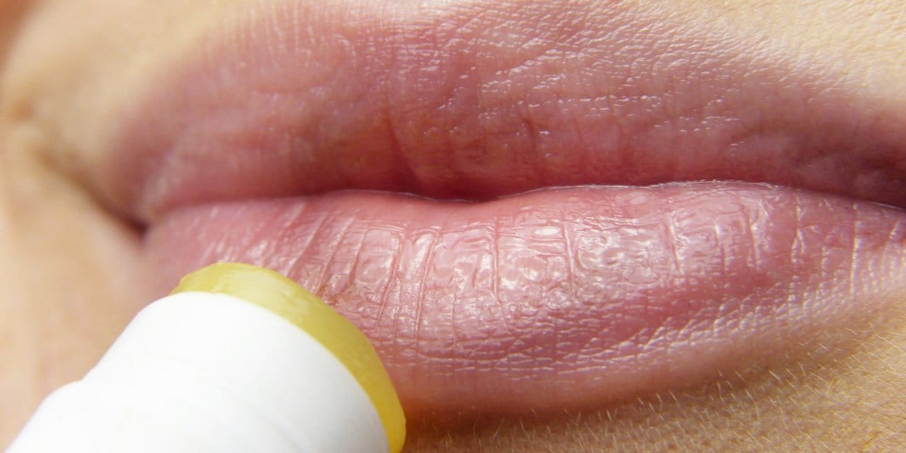 Öpüştükten Sonra Dudakları Yandı