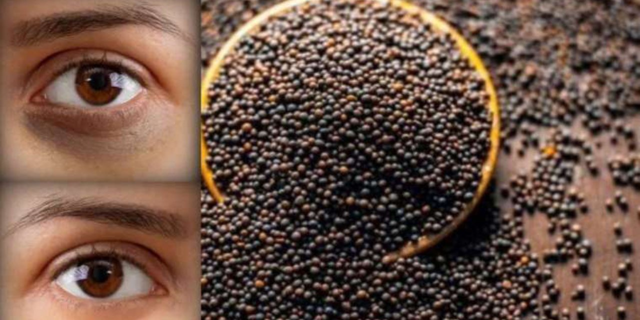 Mucizevi bitki göz altı morluklarından kurtarıyor... 1 çay kaşığı kullanmanız yeterli!