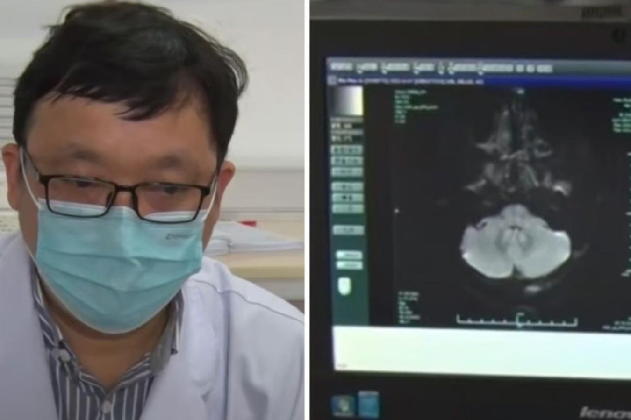 Çinli doktor aynı restoranda yemek yediği kadının yüzüne bakınca beyninde tümör olduğunu farketti