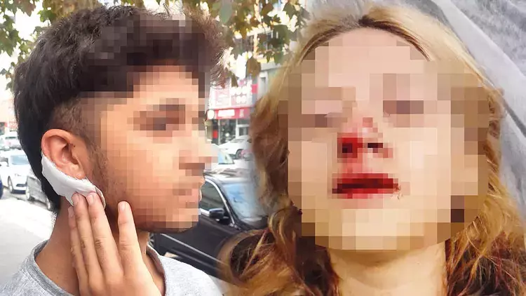 Sultangazi'de Vahşet! Yüzüne Taş Atıp Dişlerini Kırdılar