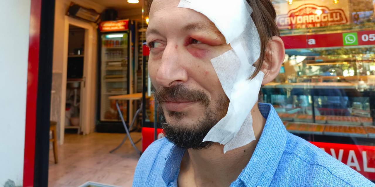 İstanbul'da Akılalmaz Olay! 'Ne Bakıyorsun' Deyip Başına Bıçağı Sapladı