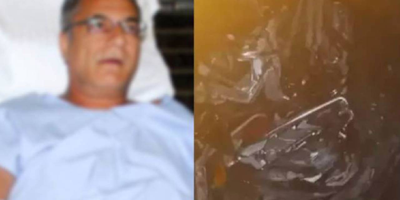 Mehmet Ali Erbil trafik kazası geçirdi