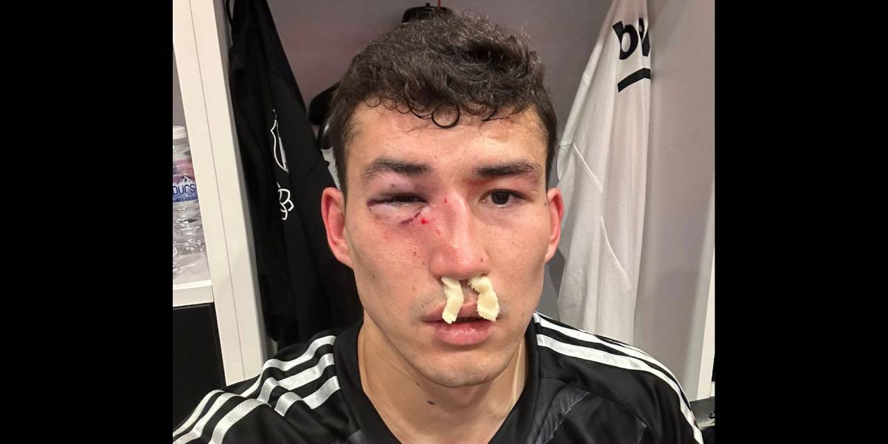 Hastaneye Kaldırıldı, Beşiktaş'tan Tepki: 'Yorumsuz' Diyerek Futbolcunun Son Halini Paylaştılar