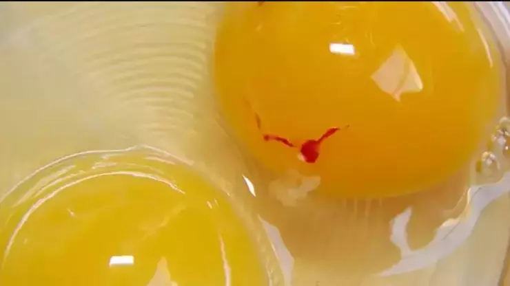 Yumurta Sarısının Üzerinde Gördüğümüz Kan Lekesi Embriyo Değilse Nedir?