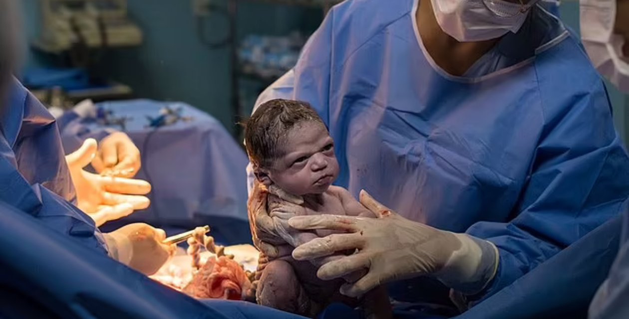 Sosyal Medyada Viral Olan O Fotoğraftaki Bebek Büyüdü... İlk Fotoğrafındaki Somurtkan Hallerinden İse Eser Yok