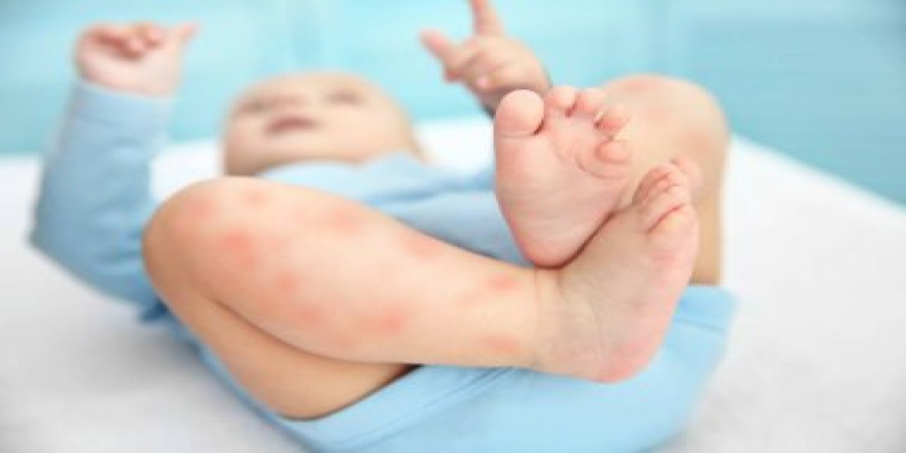 Bebekleri tehlikeli yiyeceklerle beslemek: Bilim insanları çocuklarda alerjiyi önlemenin riskli bir yolunu buldu