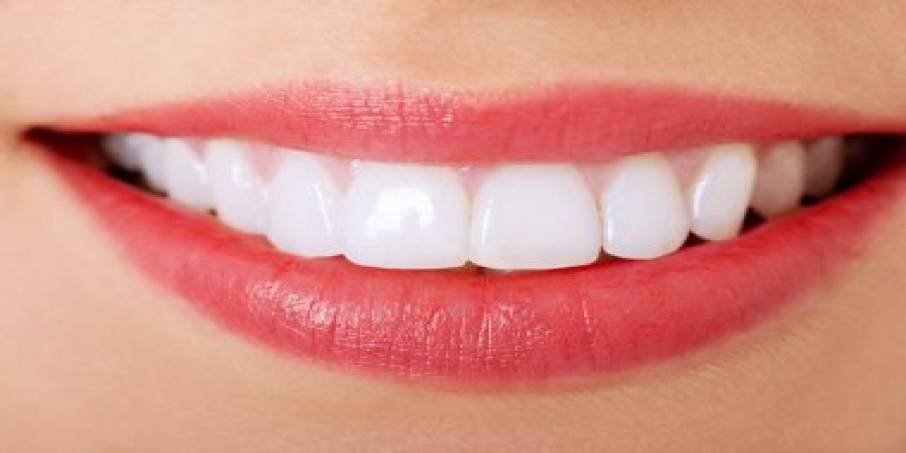 Kırmızı halıda yürümeyebilirsiniz ama dişlerinizi diş minenize zarar vermeden nasıl beyazlatacağınızı bilmekten zarar gelmez...