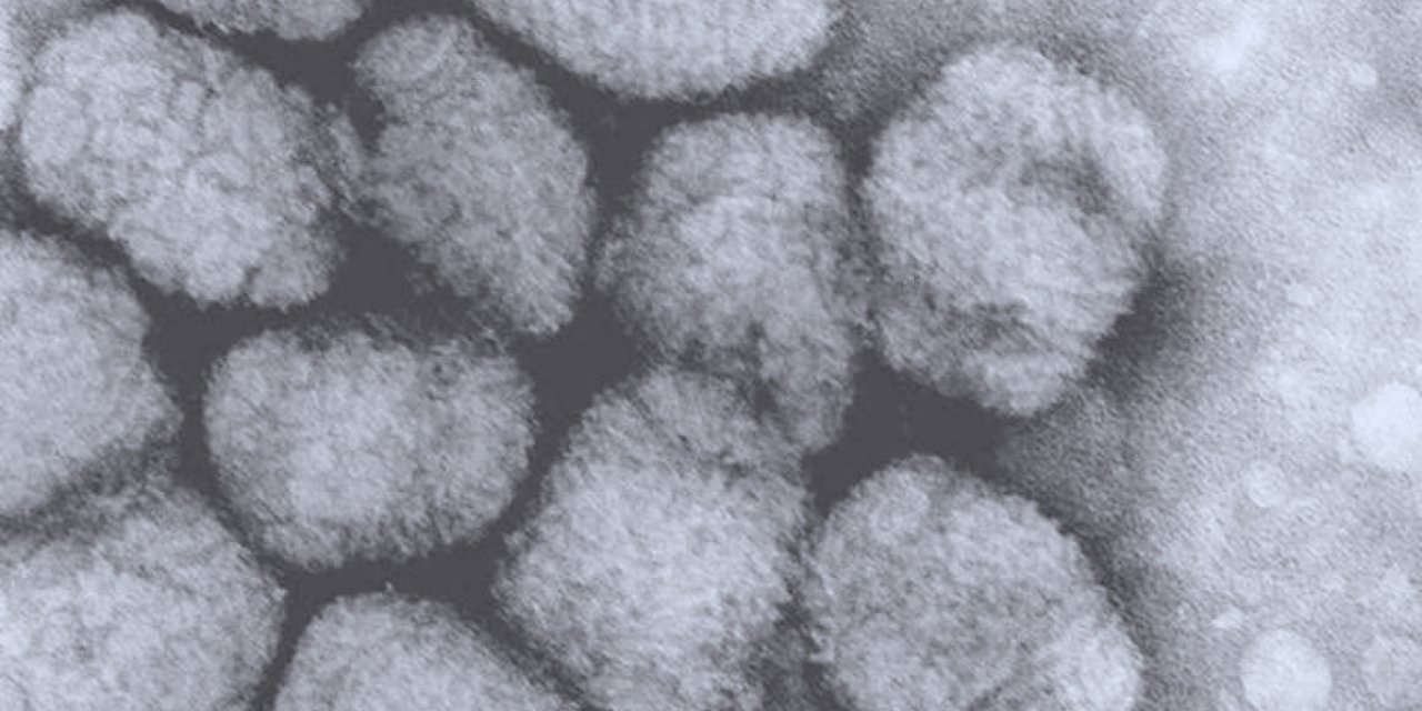 Bağışıklık Sistemi Zayıf Olanlar Dikkatli Olsun: ABD'de 'Alaska Çiçeği' Virüsünden İlk Ölüm!
