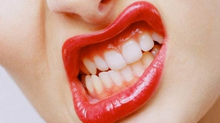 Gece uykusunda diş sıkanlar dikkat