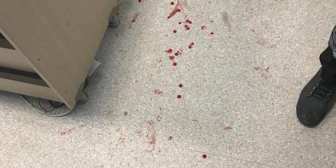 Suruç Devlet Hastanesinde Sekreteri Zımba İle Dövdüler!