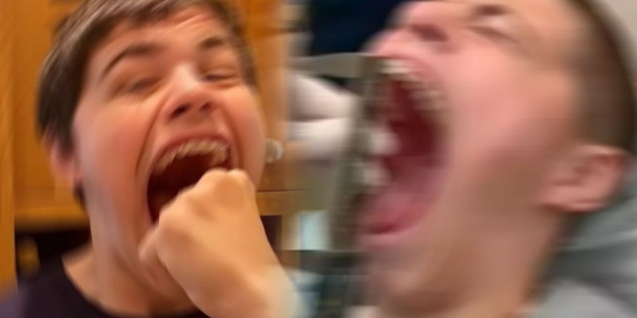 ''Yok Artık'' Dedirten Rekor! Yetkililer Şaştı Kaldı, Ağzını 10 Cm'den Fazla Açıyor