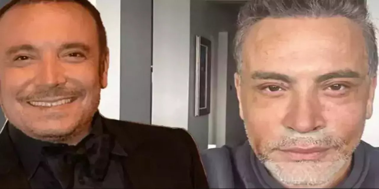 Cenk Eren'in Estetik Faturası Ortaya Çıktı! Fiyatı Dudak Uçuklattı