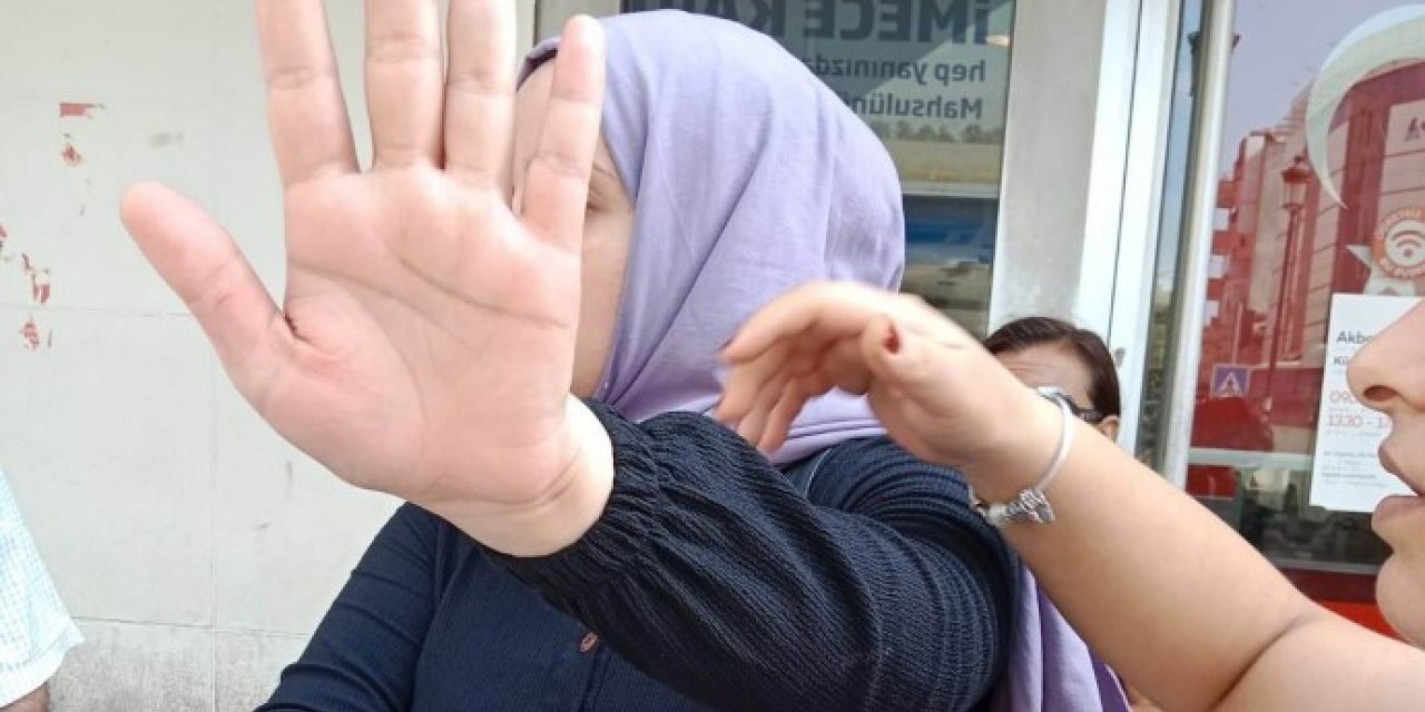 HDP Binasını Yakmaya Çalışan Kadınla İlgili Flaş Gelişme!