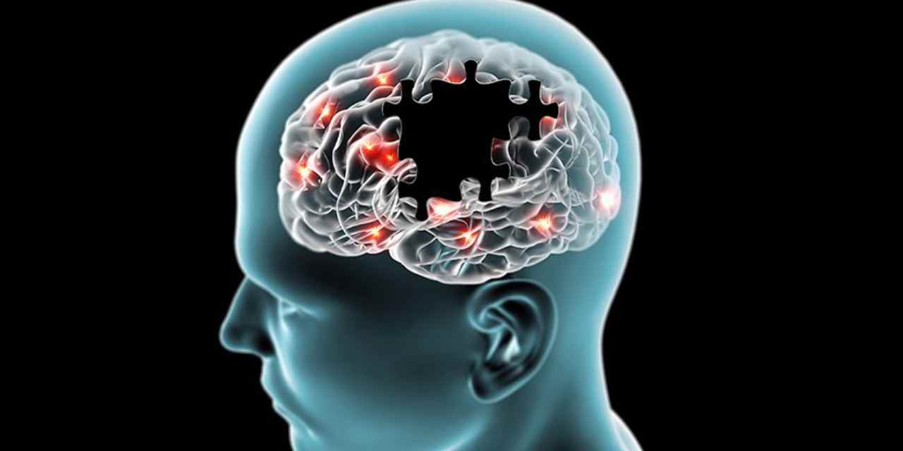 Umut Verici Keşif: Alzheimer Riskini Yüzde 71 Azaltan Gen Bulundu