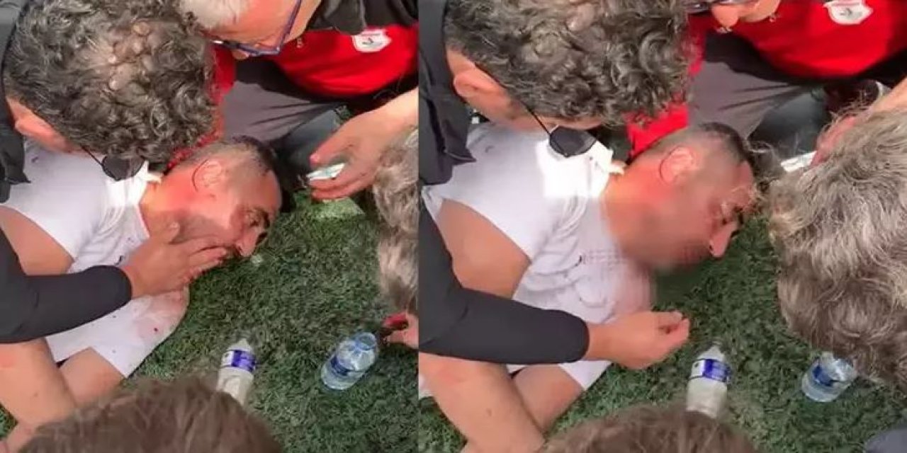 Maç Sonu Çıkan Kavgada Antrenörün Dili Boğazına Kaçtı